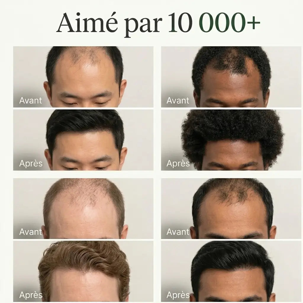 CapilNova™ — Stoppez la chute et retrouvez des cheveux épais en 6 semaines